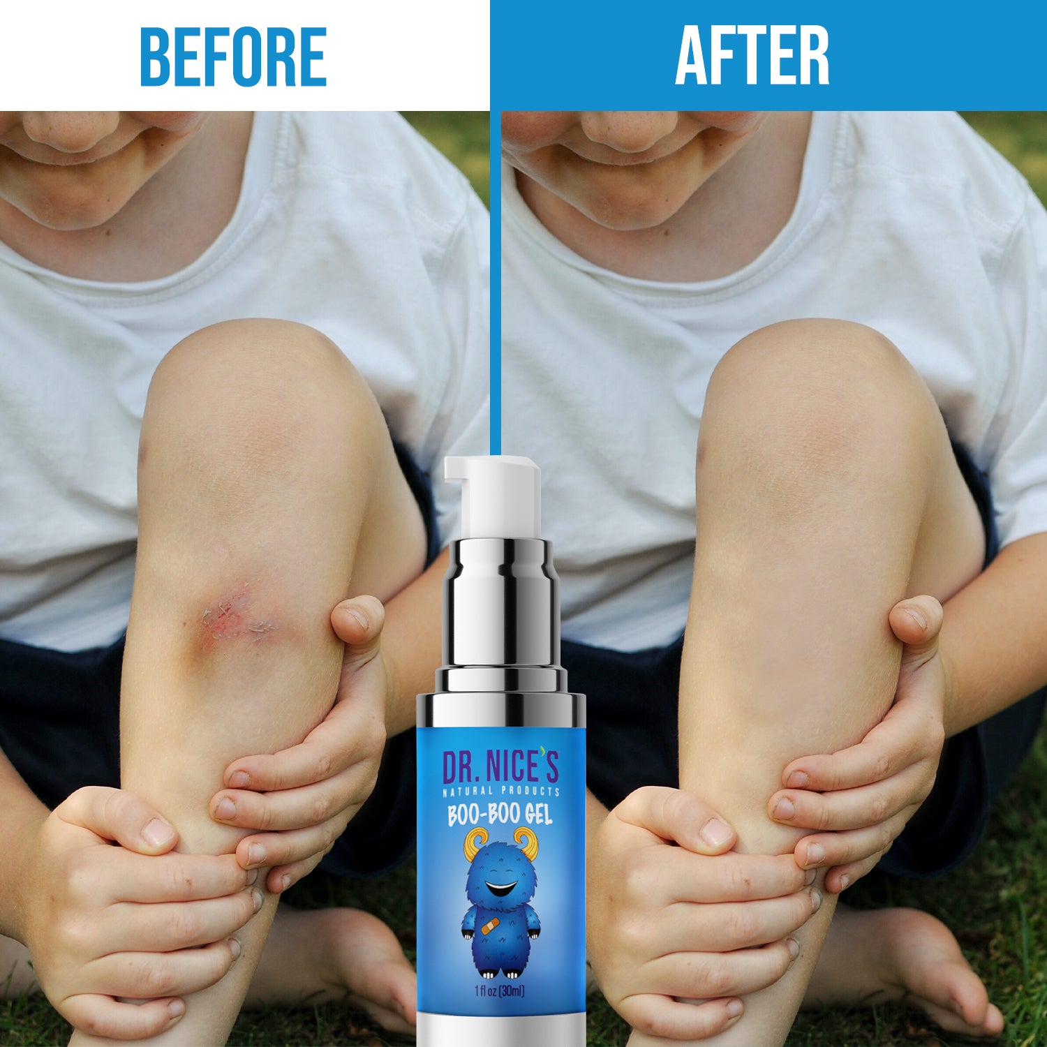Boo-Boo Gel For Kids